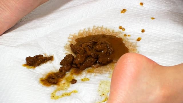 屁糞2 サンプル画像 11